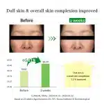 Dr. Althea Gentle Vitamin C Serum (30ml) - Image 5