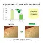 Dr. Althea Gentle Vitamin C Serum (30ml) - Image 6