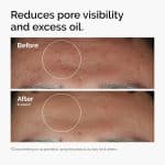 The Ordinary Niacinamide 10% + Zinc 1% - Image 2
