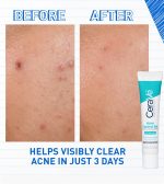 CeraVe Acne Control Gel (40ml) - Image 4