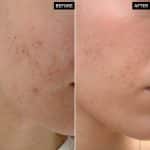 INKEY LIST MANDELIC ACID TREATMENT - Image 5