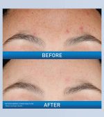 CeraVe Resurfacing Retinol Serum (30ml) - Image 6