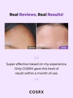 COSRX AHA/BHA Clarifying Treatment Toner (150ml) - Image 2