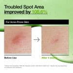 Anua Azelaic Acid 10 Hyaluron Redness Soothing Serum - Image 7
