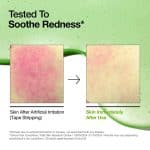 Anua Azelaic Acid 10 Hyaluron Redness Soothing Serum - Image 8