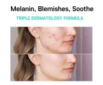 Care:Nel Anti Melasma Cica Cream (40 ml) - Image 5