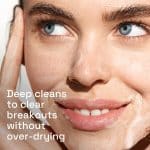 Cetaphil Gentle Clear Clarifying Acne Cream Cleanser (124 ml) - Image 5
