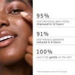 Inkey list succinic acid acne treatment - Image 3