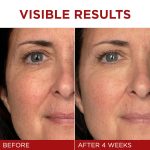 L'Oréal Paris Revitalift Triple Power Anti-Aging Face Moisturizer (48 g) - Image 3