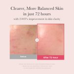 medicube TXA Niacinamide 15% Serum (30ml) - Image 6