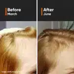 Minimalist Hair Growth Actives 18% Hair Serum (30 ml) - Image 2