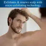 Nizoral Pre-Shampoo Scalp Build-Up Remover with Micro Exfoliating Technology (148 ml) - Image 2