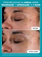 Paula’s Choice SKIN PERFECTING 2% BHA Liquid Exfoliant - Image 2