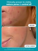 Paula’s Choice SKIN PERFECTING 2% BHA Liquid Exfoliant - Image 3