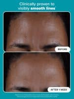 Paula’s Choice SKIN PERFECTING 2% BHA Liquid Exfoliant - Image 4