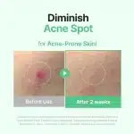 Purito Wonder Releaf Centella Serum Unscented - Image 5