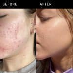 The INKEY List Niacinamide Serum (30 ml) - Image 2