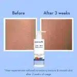 WishCare AHA + BHA Body Lotion (200 ml) - Image 7