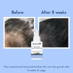 WishCare Hair Growth Serum Concentrate (30 ml) - Image 7