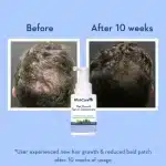 WishCare Hair Growth Serum Concentrate (30 ml) - Image 8